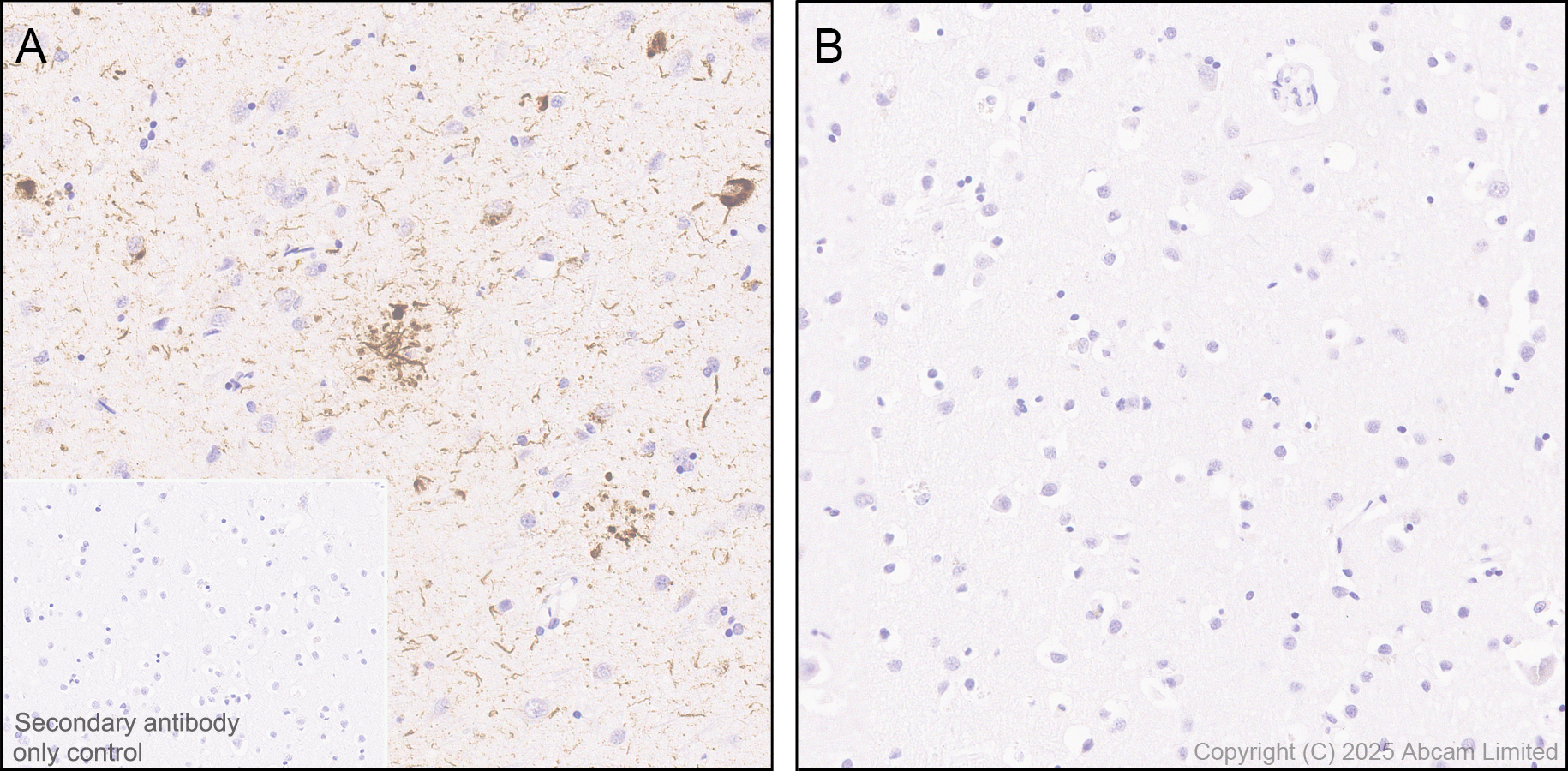Immunohistochemistry (Formalin/PFA-fixed paraffin-embedded sections) - Anti-Tau (phospho T212 + S214) antibody [EPR27523-252] (ab324015), expandable thumbnail