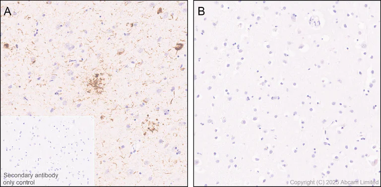 Immunohistochemistry (Formalin/PFA-fixed paraffin-embedded sections) - Anti-Tau (phospho T212 + S214) antibody [EPR27523-252] (AB324015)