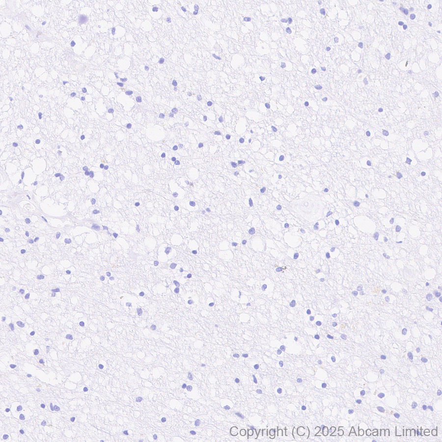 Immunohistochemistry (Formalin/PFA-fixed paraffin-embedded sections) - Anti-Tau (phospho T212 + S214) antibody [EPR27523-252] (AB324015), expandable thumbnail