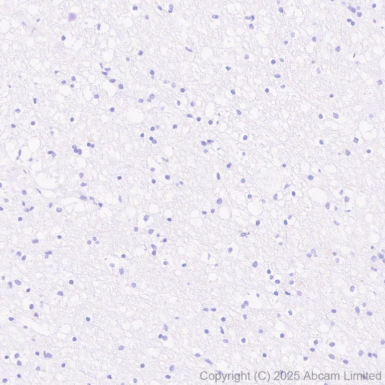 Immunohistochemistry (Formalin/PFA-fixed paraffin-embedded sections) - Anti-Tau (phospho T212 + S214) antibody [EPR27523-252] (AB324015)