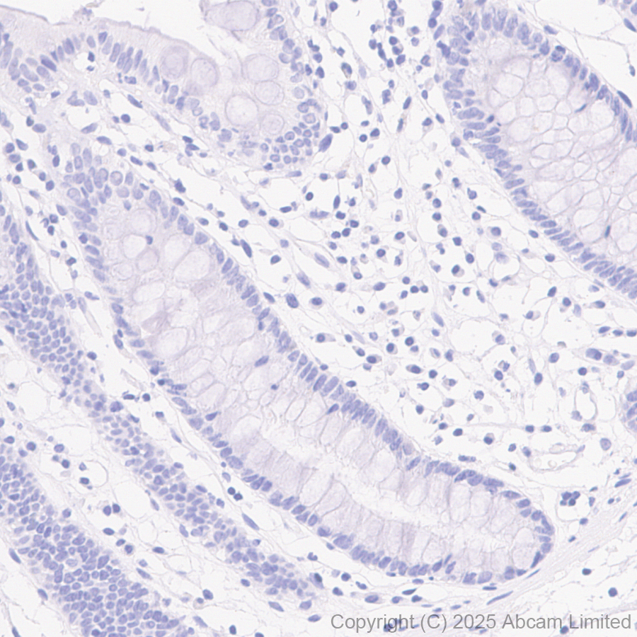 Immunohistochemistry (Formalin/PFA-fixed paraffin-embedded sections) - Anti-Tau (phospho T212 + S214) antibody [EPR27523-252] (AB324015), expandable thumbnail