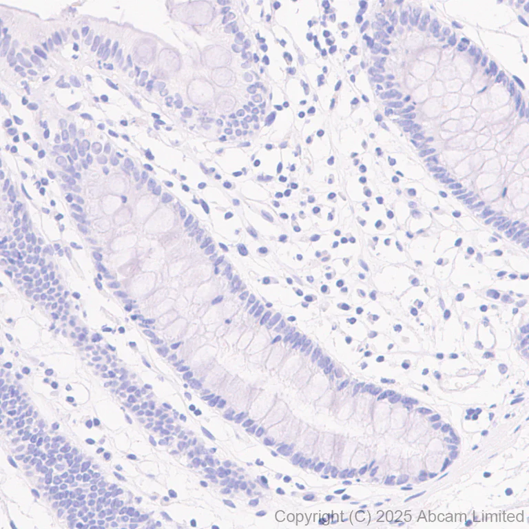 Immunohistochemistry (Formalin/PFA-fixed paraffin-embedded sections) - Anti-Tau (phospho T212 + S214) antibody [EPR27523-252] (AB324015)