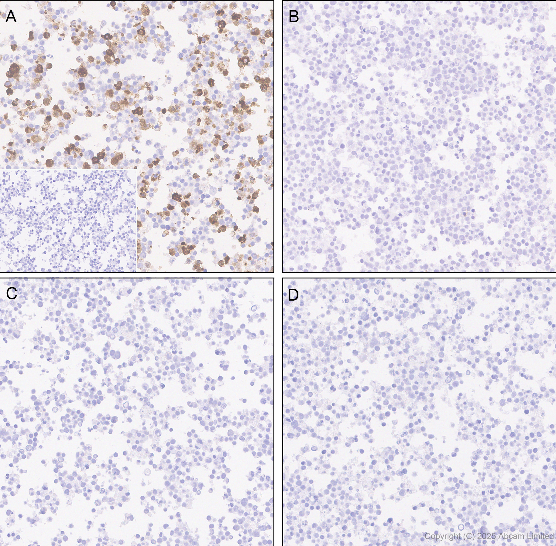 Immunohistochemistry (Formalin/PFA-fixed paraffin-embedded sections) - Anti-Tau (phospho T212 + S214) antibody [EPR27523-252] (AB324015), expandable thumbnail