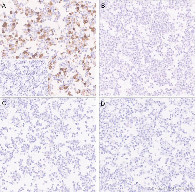 Immunohistochemistry (Formalin/PFA-fixed paraffin-embedded sections) - Anti-Tau (phospho T212 + S214) antibody [EPR27523-252] (AB324015)