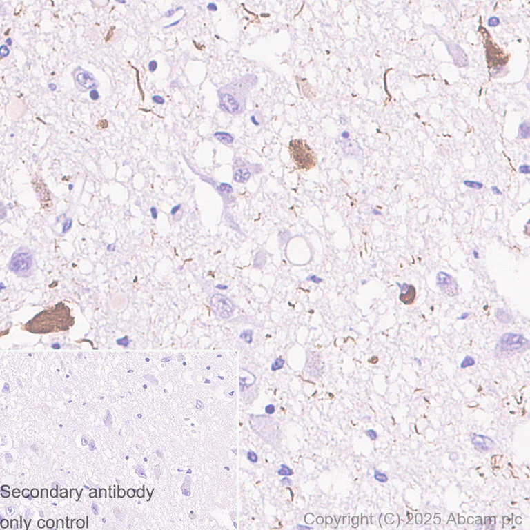 Immunohistochemistry (Formalin/PFA-fixed paraffin-embedded sections) - Anti-Tau (phospho T217) antibody [EPR24654-110] (AB291080)