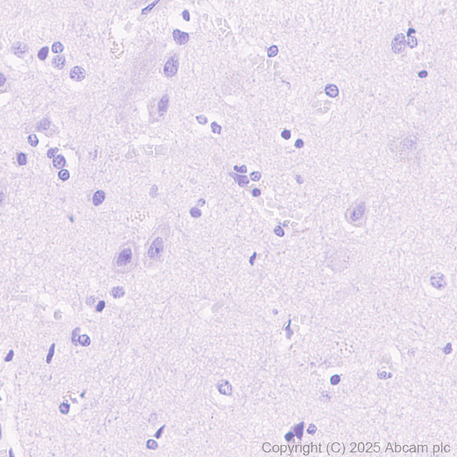 Immunohistochemistry (Formalin/PFA-fixed paraffin-embedded sections) - Anti-Tau (phospho T217) antibody [EPR24654-110] (AB291080)