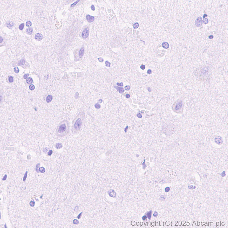 Immunohistochemistry (Formalin/PFA-fixed paraffin-embedded sections) - Anti-Tau (phospho T217) antibody [EPR24654-110] (AB291080)