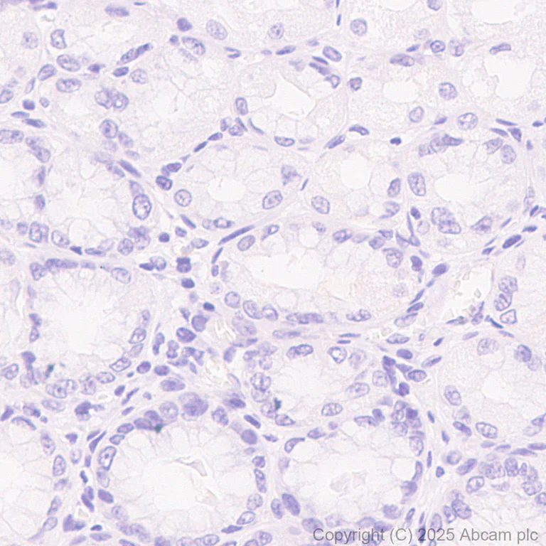 Immunohistochemistry (Formalin/PFA-fixed paraffin-embedded sections) - Anti-Tau (phospho T217) antibody [EPR24654-110] (AB291080)