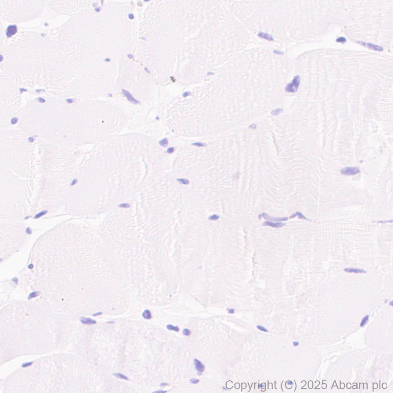 Immunohistochemistry (Formalin/PFA-fixed paraffin-embedded sections) - Anti-Tau (phospho T217) antibody [EPR24654-110] (AB291080)