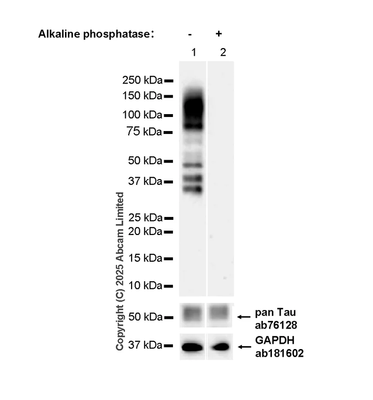 Western blot - Anti-Tau (phospho T217) antibody [EPR24654-110] (AB291080)
