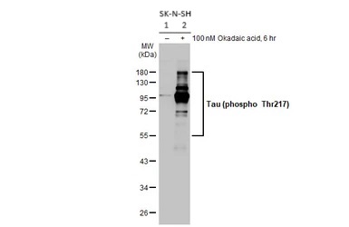Western blot - Anti-Tau (phospho T217) antibody [HL1276] (AB308355), expandable thumbnail