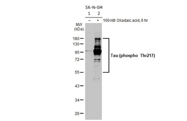 Western blot - Anti-Tau (phospho T217) antibody [HL1276] (AB308355)