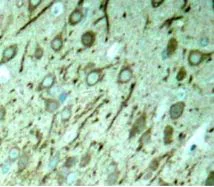 Immunohistochemistry (Formalin/PFA-fixed paraffin-embedded sections) - Anti-Tau (phospho T231) antibody (AB194815)