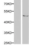 Western blot - Anti-Tau (phospho T231) antibody (AB194815)