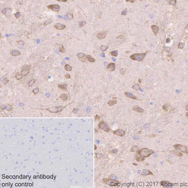Immunohistochemistry (Formalin/PFA-fixed paraffin-embedded sections) - Anti-Tau (phospho T231) antibody [EPR2488] (AB151559)