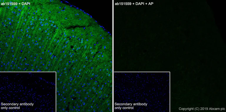 Immunohistochemistry (Frozen sections) - Anti-Tau (phospho T231) antibody [EPR2488] (AB151559)