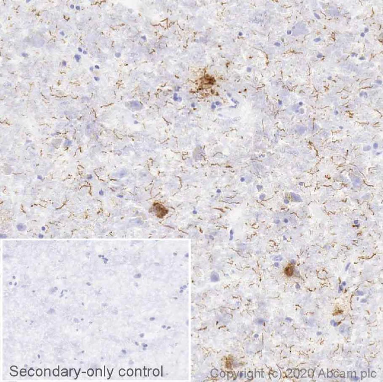 Immunohistochemistry (Frozen sections) - Anti-Tau (phospho T231) antibody [EPR2488] (AB151559)