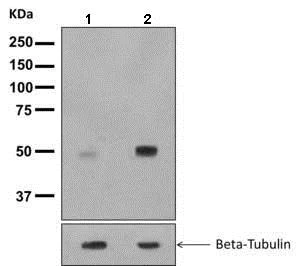 Western blot - Anti-Tau (phospho T231) antibody [EPR2488] (AB151559)