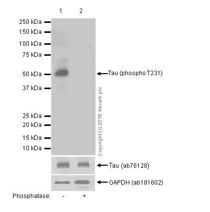 Western blot - Anti-Tau (phospho T231) antibody [EPR2488] (AB151559)