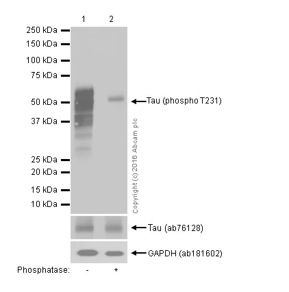 Western blot - Anti-Tau (phospho T231) antibody [EPR2488] (AB151559)