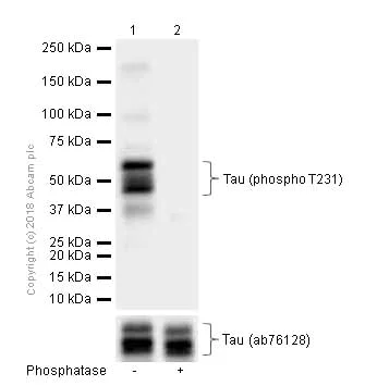Western blot - Anti-Tau (phospho T231) antibody [EPR2488] (AB151559)