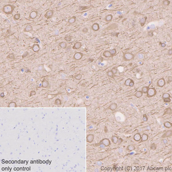 Immunohistochemistry (Formalin/PFA-fixed paraffin-embedded sections) - Anti-Tau (phospho T231) antibody [EPR2488] - BSA and Azide free (AB156624)