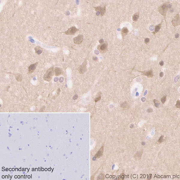 Immunohistochemistry (Formalin/PFA-fixed paraffin-embedded sections) - Anti-Tau (phospho T231) antibody [EPR2488] - BSA and Azide free (AB156624)