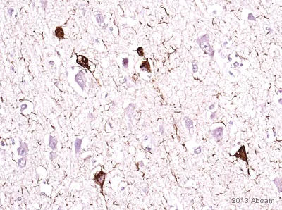 Immunohistochemistry (Formalin/PFA-fixed paraffin-embedded sections) - Anti-Tau (phospho T231) antibody [EPR2488] - BSA and Azide free (AB156624)