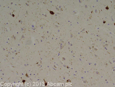 Immunohistochemistry (Formalin/PFA-fixed paraffin-embedded sections) - Anti-Tau (phospho T231) antibody [EPR2488] - BSA and Azide free (AB156624)