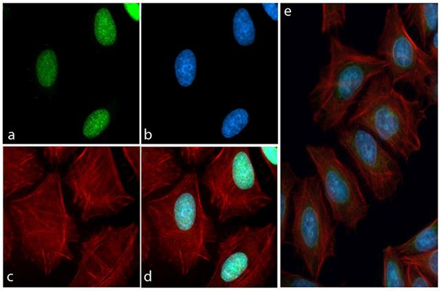 Immunocytochemistry/ Immunofluorescence - Anti-Tau (phospho T231) antibody [RP23040023] (AB307987), expandable thumbnail