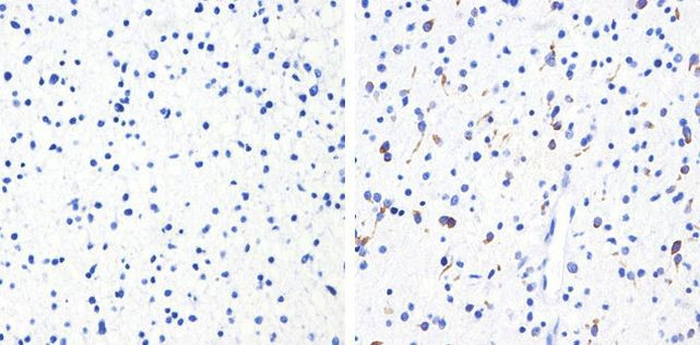 Immunohistochemistry paraffin embedded sections - Anti-Tau (phospho T231) antibody [RP23040023] (AB307987), expandable thumbnail