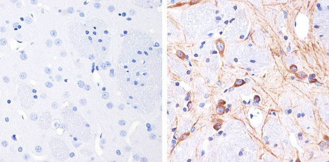 Immunohistochemistry paraffin embedded sections - Anti-Tau (phospho T231) antibody [RP23040023] (AB307987), expandable thumbnail