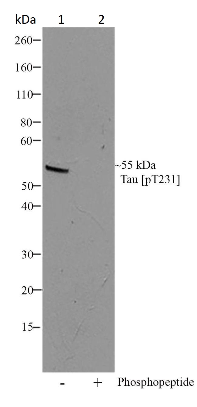 Western blot - Anti-Tau (phospho T231) antibody [RP23040023] (AB307987), expandable thumbnail