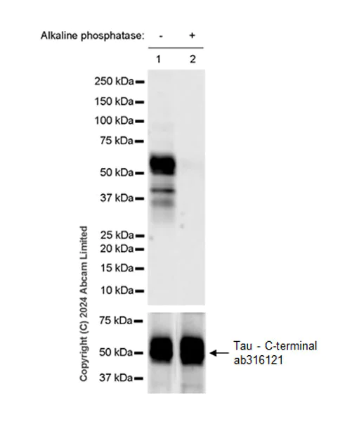 Western blot - Anti-Tau (phospho T50) antibody [EPR29148-44] - BSA and Azide free (AB324765)