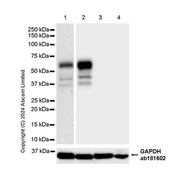 Western blot - Anti-Tau (phospho T50) antibody [EPR29148-44] - BSA and Azide free (AB324765)
