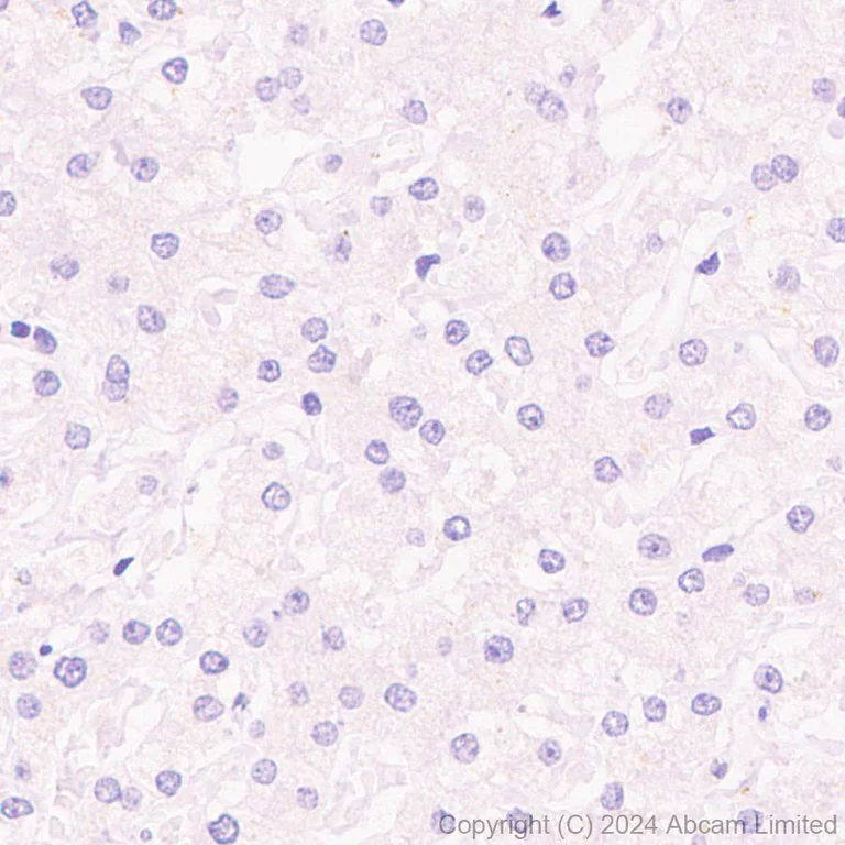 Immunohistochemistry (Formalin/PFA-fixed paraffin-embedded sections) - Anti-Tau (phospho T69) antibody [EPR29149-92] - BSA and Azide free (AB324840)