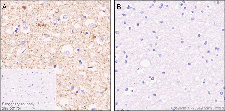 Immunohistochemistry (Formalin/PFA-fixed paraffin-embedded sections) - Anti-Tau (phospho T69) antibody [EPR29149-92] - BSA and Azide free (AB324840)
