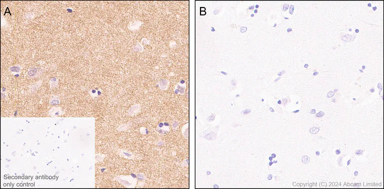 Immunohistochemistry (Formalin/PFA-fixed paraffin-embedded sections) - Anti-Tau (phospho T69) antibody [EPR29149-92] - BSA and Azide free (AB324840)