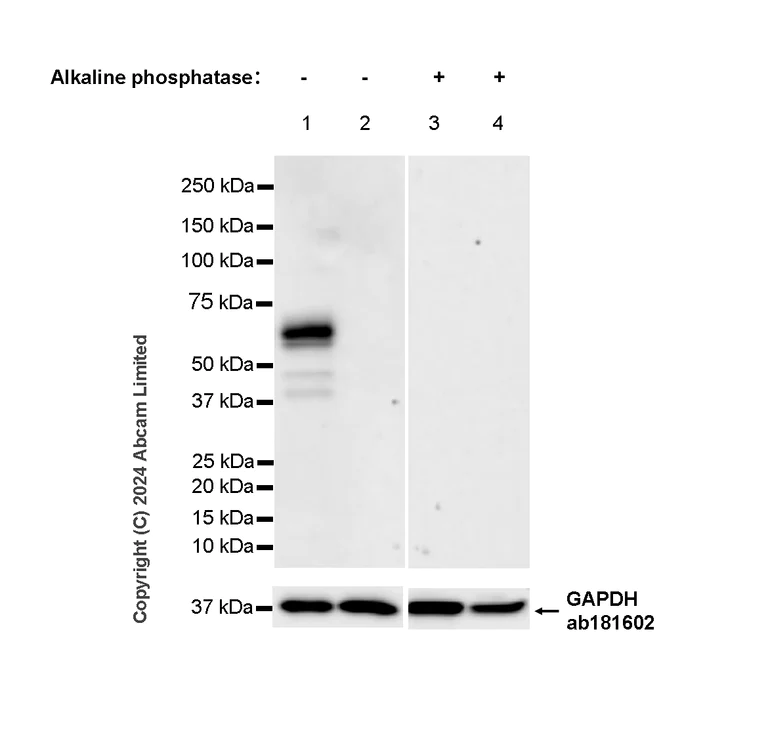 Western blot - Anti-Tau (phospho T69) antibody [EPR29149-92] - BSA and Azide free (AB324840)