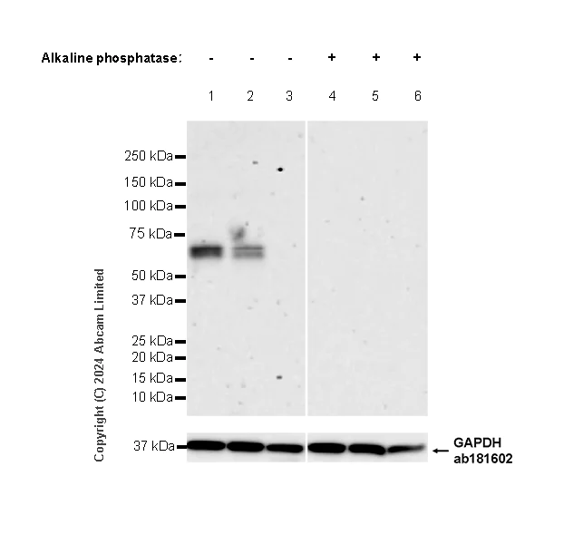 Western blot - Anti-Tau (phospho T69) antibody [EPR29149-92] - BSA and Azide free (AB324840)