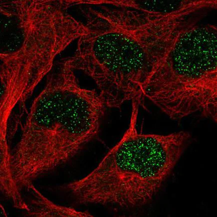 Immunocytochemistry/ Immunofluorescence - Anti-TAZ antibody [CL0371] (AB242313)