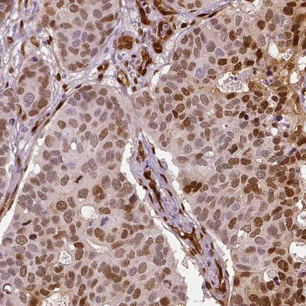 Immunohistochemistry (Formalin/PFA-fixed paraffin-embedded sections) - Anti-TAZ antibody [CL0371] (AB242313)