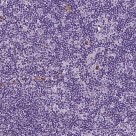 Immunohistochemistry (Formalin/PFA-fixed paraffin-embedded sections) - Anti-TAZ antibody [CL0371] (AB242313)