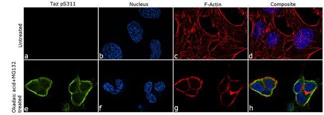Immunocytochemistry - Anti-TAZ (phospho S311) antibody [14HCLC] (AB277791), expandable thumbnail