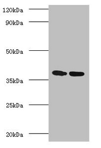 Western blot - Anti-TB Ag85A antibody (AB193499)