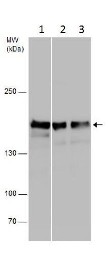 Western blot - Anti-TBC1D1 antibody (AB229504)