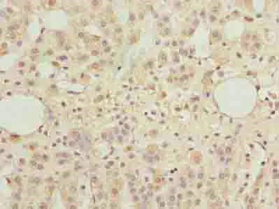 Immunohistochemistry (Formalin/PFA-fixed paraffin-embedded sections) - Anti-TBC1D14 antibody (AB235544)