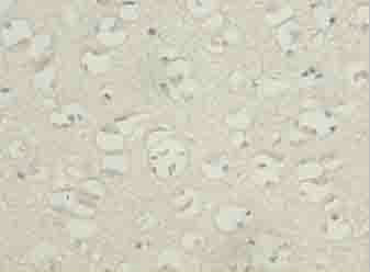 Immunohistochemistry (Formalin/PFA-fixed paraffin-embedded sections) - Anti-TBC1D14 antibody (AB235544)