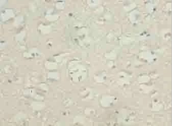 Immunohistochemistry (Formalin/PFA-fixed paraffin-embedded sections) - Anti-TBC1D14 antibody (AB235544)