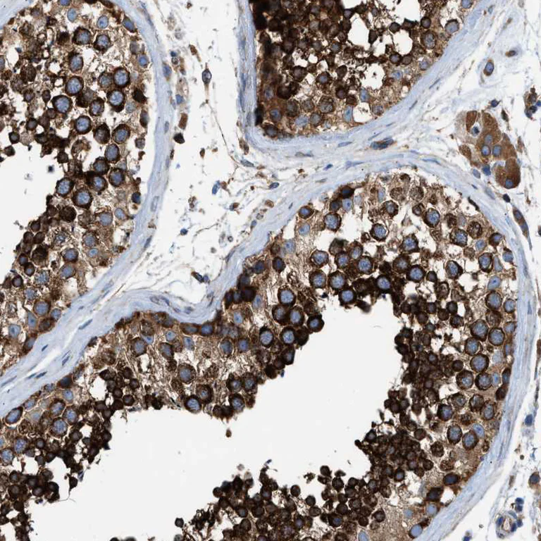 Immunohistochemistry (Formalin/PFA-fixed paraffin-embedded sections) - Anti-TBC1D15 antibody (AB121396)